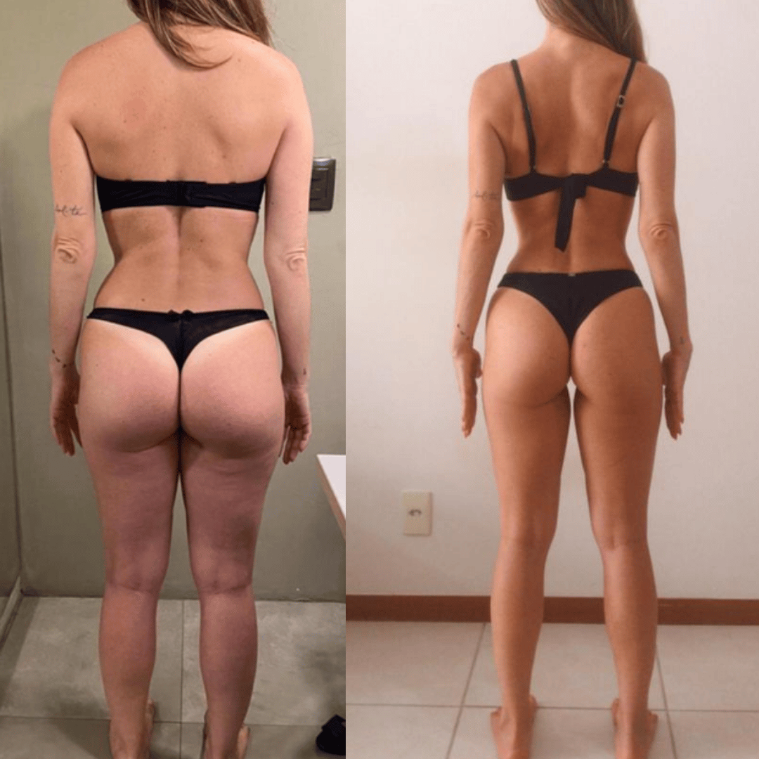 modelo_antes_e_depois